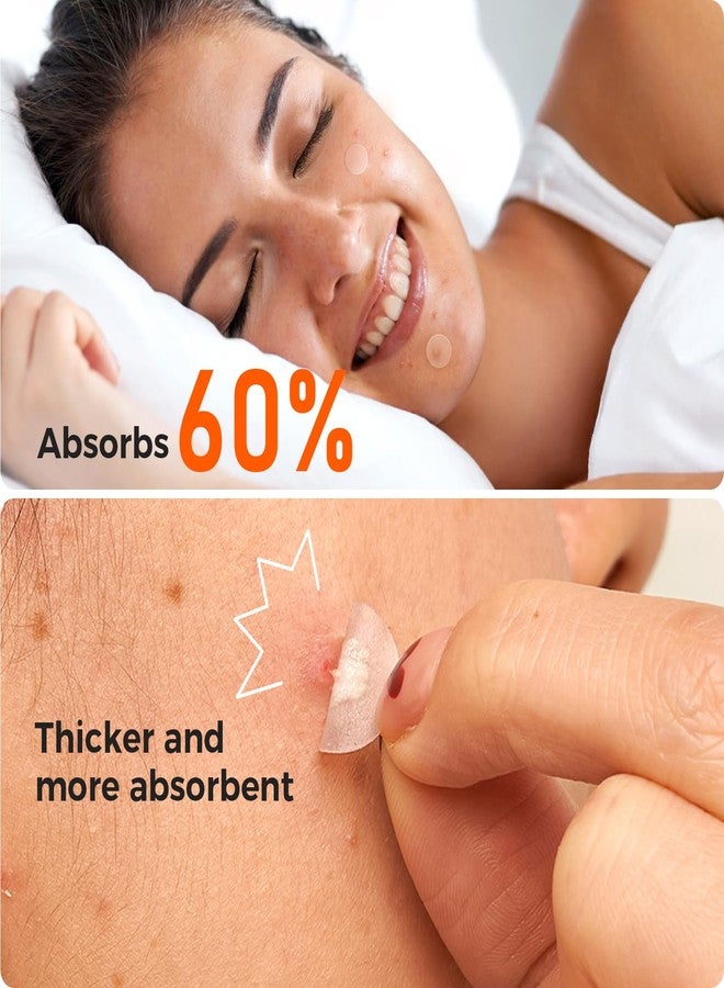 تي كيه تي كيه لصقات TKTK لعلاج حب الشباب للوجه، 435 لصقة بأربعة أحجام، لصقات لعلاج حب الشباب ليلاً ونهاراً، لصقات هيدروكولويد رقيقة وسميكة لتغطية البثور والعيوب وحب الشباب - Image 3